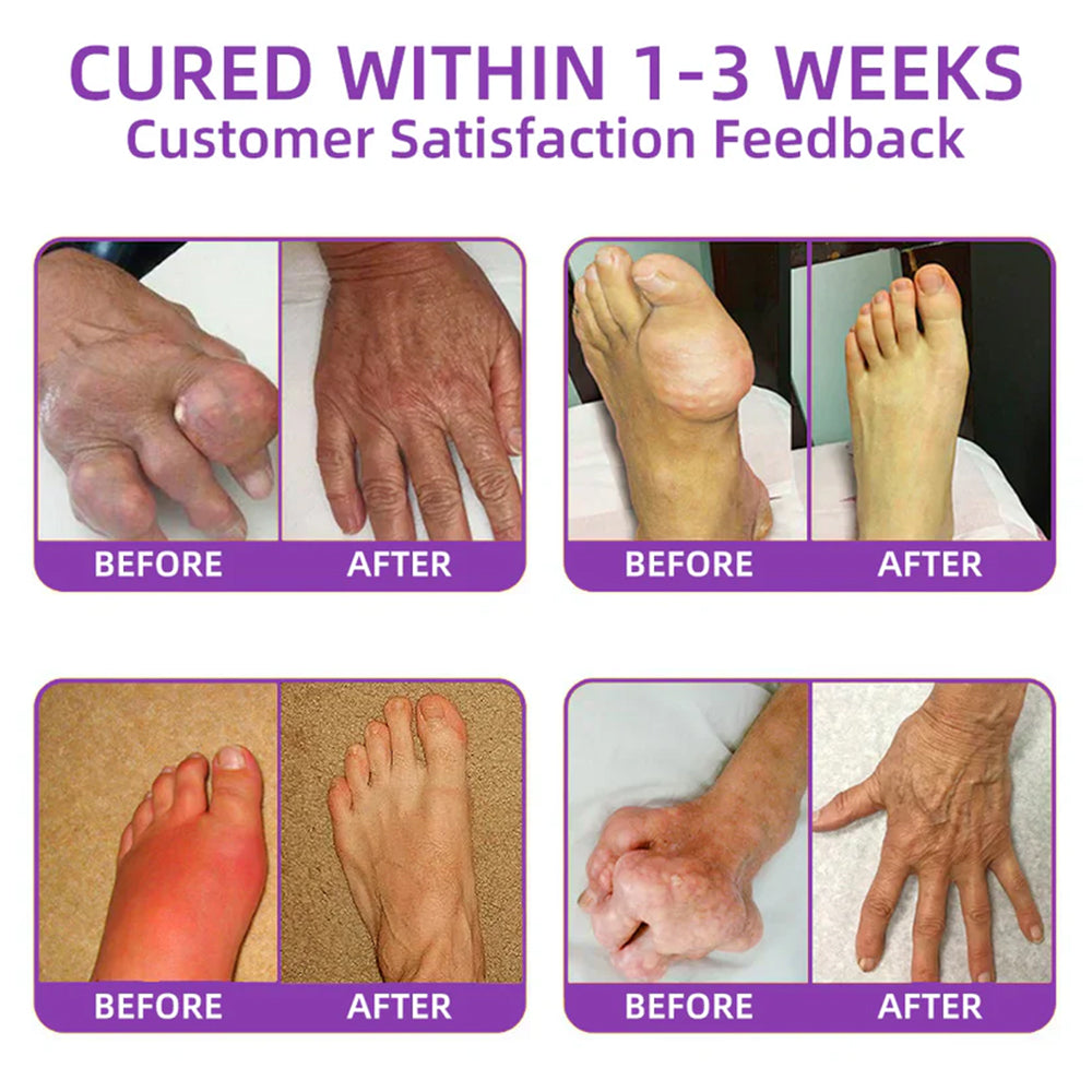 𝐓𝐋𝐎𝐏𝐀® Shark Cartilage Pain-Soothing Bone Recovery Gel 👨‍⚕️ Recommended by the Canadian Orthopaedic Association (COA) (5-minute pain relief, 7 days to restore joint mobility, 4 weeks for complete recovery) 🔥